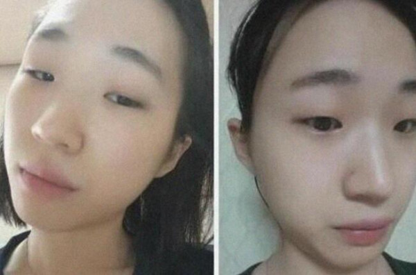 第1張圖片