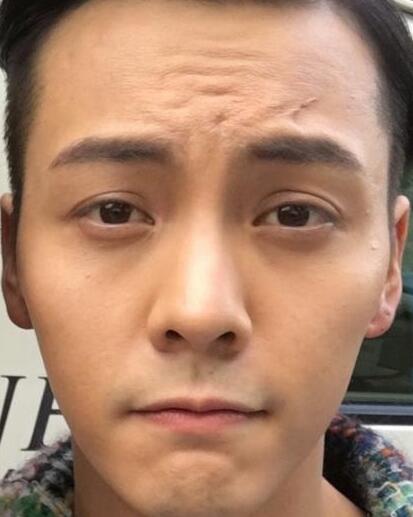 第1張圖片