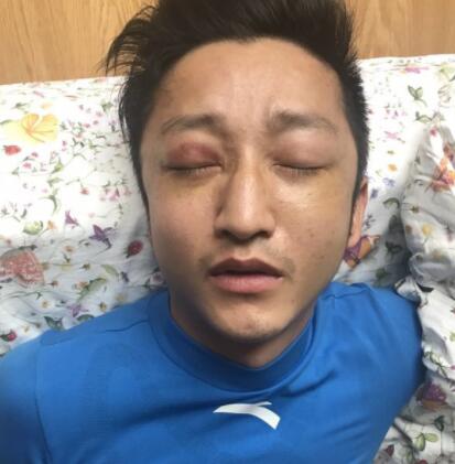 第1張圖片
